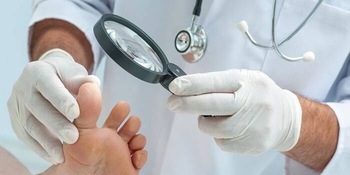 Lekár skúma nohu pacienta s bodcom s lupou